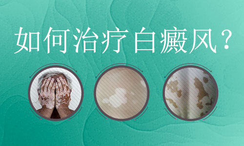 警惕白斑的症状可能会是白癜风