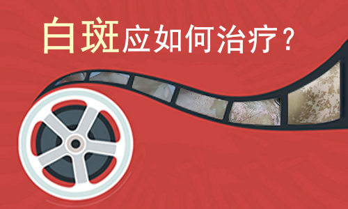治疗白癜风的新技术是什么